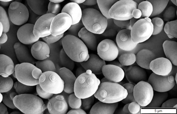 Penampakan ragi roti dengan mikroskop elektron (Scanning Electron Microscope)