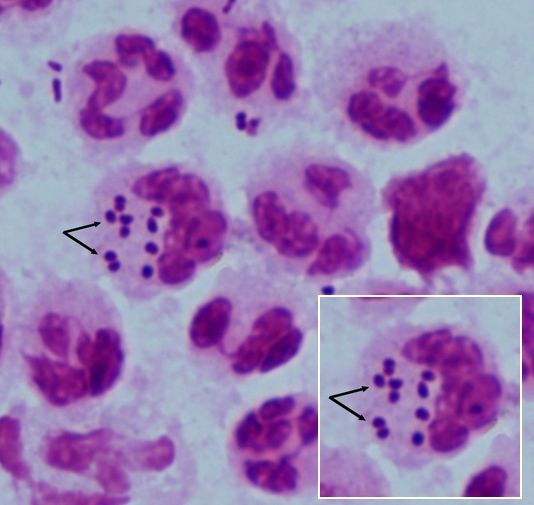 Sumber: microbiologyinpictures.com