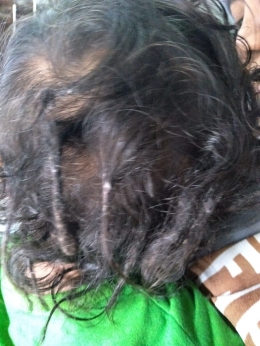 Ini dia penampakan rambut gimbal Dilan. Dokpri