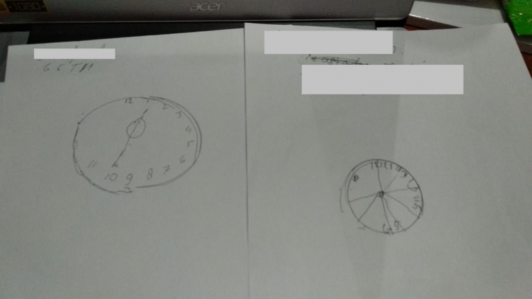 Hasil deteksi dini demensia dengan Clock Drawing Test. Dokpri
