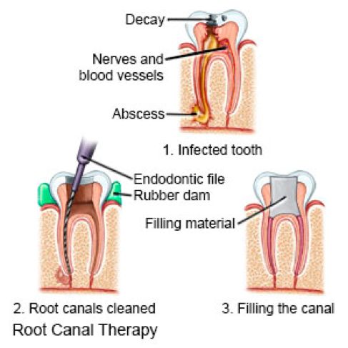 Sumber gambar: https://www.drugs.com/