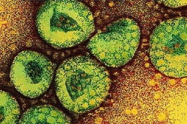 Virus Corona | Gambar: KOMPAS.com/bbc.co.uk