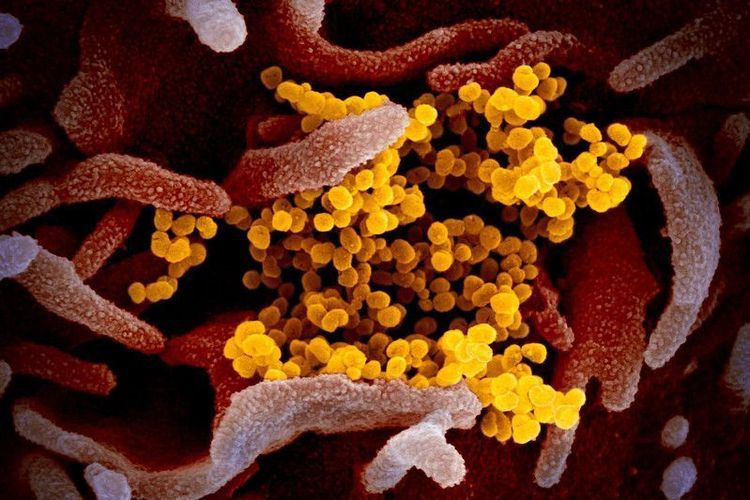 Gambar mikroskop elektron pemindai ini menunjukkan virus corona Wuhan atau Covid-19 (kuning) di antara sel manusia (merah). Kompas.com