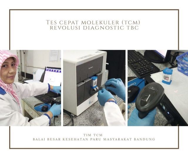 Mesin Tes Cepat Molekuler (TCM) untuk mendeteksi penyakit TBC yang kini sedang dicoba penerapannya untuk mendeteksi penyakit Covid-19 akibat virus corona (kumparan.com).