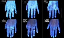 Jennie Agg, kontributor Daily Mail, menggunakan gel Glo Germ yang menunjukkan bagaimana mikroba melekat pada kulit. Bahan yang mengandung partikel khusus yang glowing di bawah sinar UV. Biasanya digunakan sebagai visual aid dalam pelatihan tenaga kesehatan.