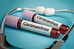 China menemukan salah satu cara menyembuhkan infeksi virus corona, yakni dengan plasma darah bekas penderitanya (Gambar: Shutterstock.com via Kompas.com)