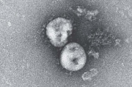 Ilustrasi Virus Corona (sumber: kolom.tempo.co)
