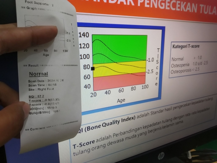 grafik Kepadatan Tulang hasil pemeriksaan digital. Dokpri