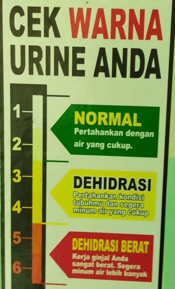 Urine (dokpri)