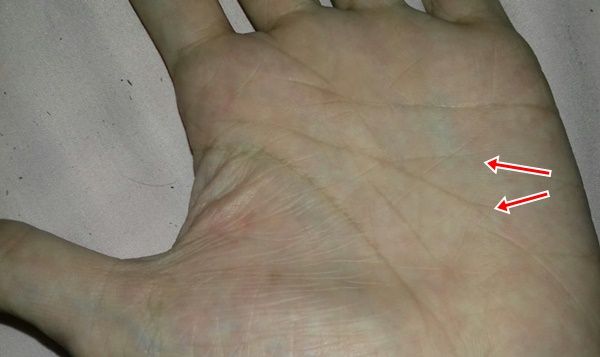 Garis tangan saya yang melengkung dan bercabang (dokpri)