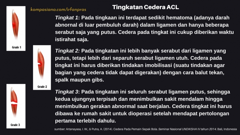 Tingkatan cedera ACL. | foto: Dokumen Pribadi