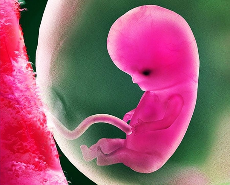 Fetus. Sumber: desiblitz.com