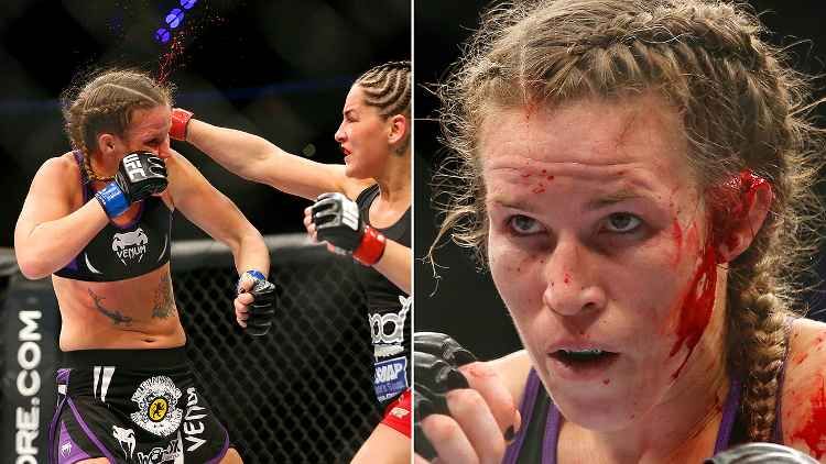 Darah mengucur deras dari telinga Leslie Smith. Telinga Cauliflower-nya meledak usai mendapat pukulan keras dari Jessica Eye (16/11/14). | Ed Mulholland via espn.com