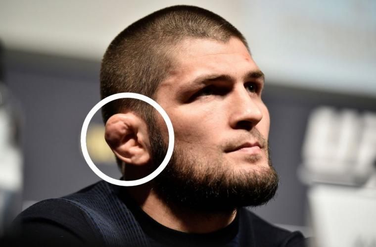 Telinga Cauliflower Khabib Nurmagomedov | getty images via talksport.com