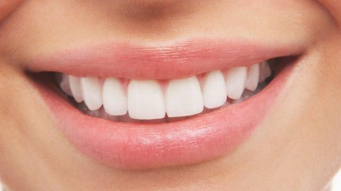 Gigi (tanya pepsodent)