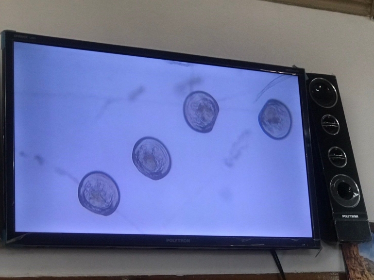 (g. 2.9 pemeriksaan larva tiram mutiara menggunakan mikroskop) | dokpri