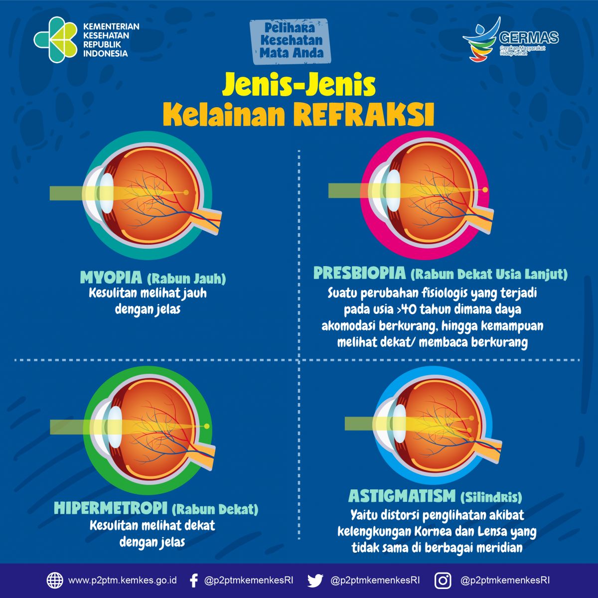 Mengenal Degenerasi Retina Perifer Dan Pencegahan Dari Kebutaan Halaman ...