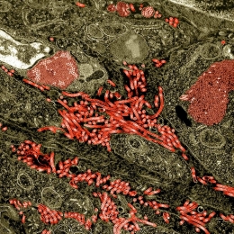 Virus Ebola (merah) pada hati primata yang tertular. Photo: NIAID