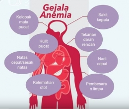 Gejala anemia dari YouTube Nutrisi Bangsa - tangkap layar dokpri