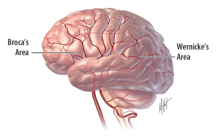 sumber : www.strokecenter.org