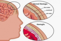 Contoh ilustrasi meninges|https://www.emingko.com