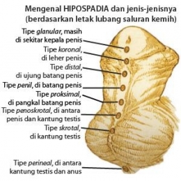 Tipe hipospadia, Sumber: halodokterku.blogspot.com