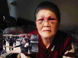 Nenek Xiao Zhen Xie korban kekerasan Anti Asia di AS (doc.HOPCLEAR, Coconuts/ed.WS)