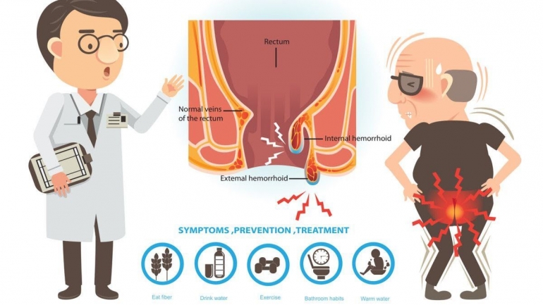 Ilustrasi (Sumber: klikdokter.com)