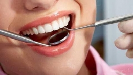Ilustrasi scaling gigi (sumber: beautynesia.id)
