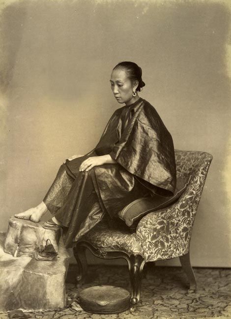 Seorang wanita dengan kaki serojanya difoto pada tahun 1870 di Hong Kong | Foto diambil dari Wikimedia