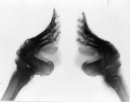 Hasil radiologi dari kaki seroja | Foto diambil dari ScienceSource