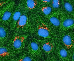 Gambar fluoresensi multiphoton dari sel HeLa | Foto diambil dari Wikipedia