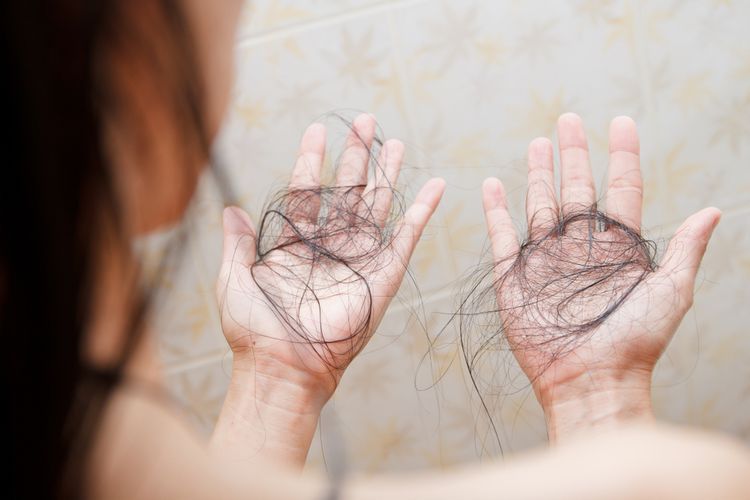 Rambut rontok salah satu tanda rambut yang rusak. (kompas)