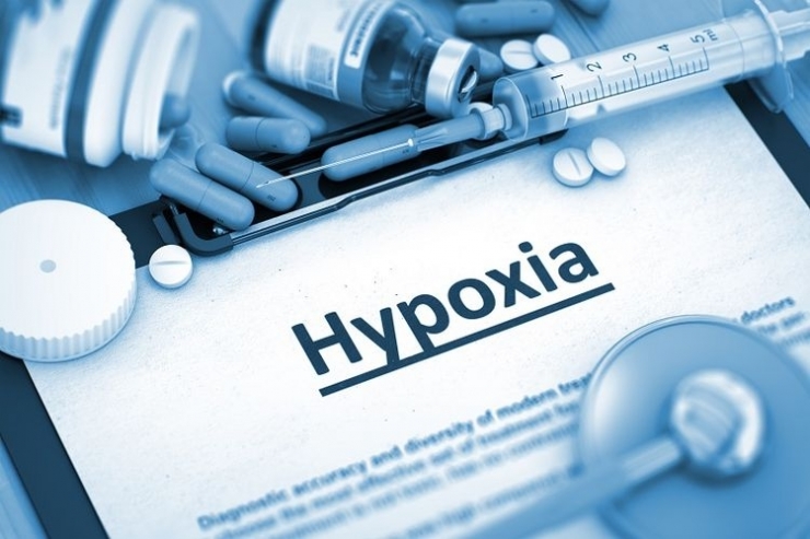 Ilustrasi kondisi happy hypoxia (Sumber. Shutterstock/Tashatuvango via Kompas.com)