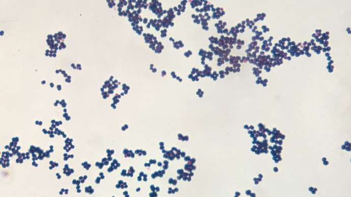 Bakteri di bawah mikroskop. (www.britannica.com)
