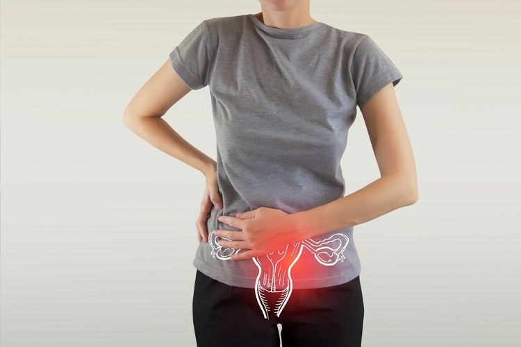 Ilustrasi kanker ovarium, kista ovarium (Shutterstock via health.kompas.com)
