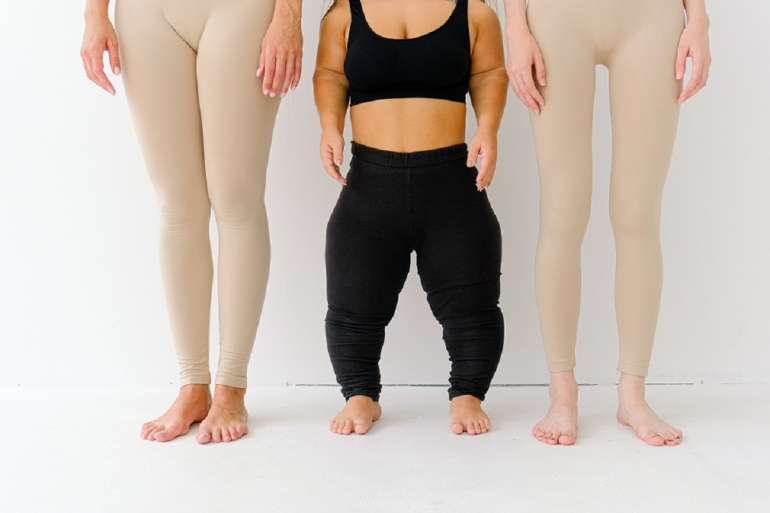 ilustrasi tubuh perempuan dalam berbagai bentuk | Photo by Anna Shvet from pexels