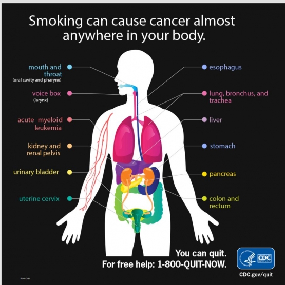 Tangkapan layar akibat merokok pada tubuh (CDC.gov)