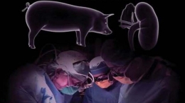Ilustrasi operasi transplantasi ginjal babi ke tubuh Rumi | Sumber: kastara.id