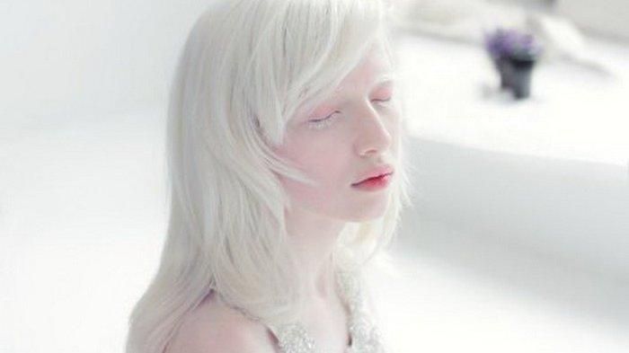 Albino. wantobizhi.com