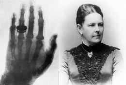 Sinar-x pertama (22 Desember 1895) adalah tangan kiri, lengkap dengan cincin kawin, dari Anna Bertha Roentgen. (Sumber: www.dailymail.co.uk)