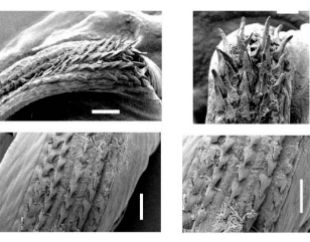 Gambar 4. Struktur radula dari Grimpoteuthis sp. (Sumber: Collins 2003)
