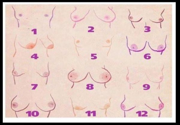 Ilustrasi berbagai bentuk payudara dengan kepribadian masing-masing (Sumber: liputan6.com)