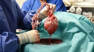 Ilustrasi tim dokter saat melakukan transplantasi jantung babi kepada salah satu pasien (sumber: dunia.tempo.co)