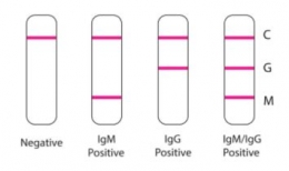 Ilustrasi hasil pemeriksaan rapid IgG-IgM (Li et al. 2020).
