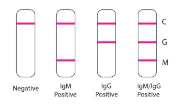 Ilustrasi hasil pemeriksaan rapid IgG-IgM (Li et al. 2020).