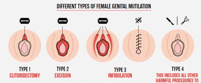 Empat tipe sunat perempuan | Foto diambil dari MyHealth