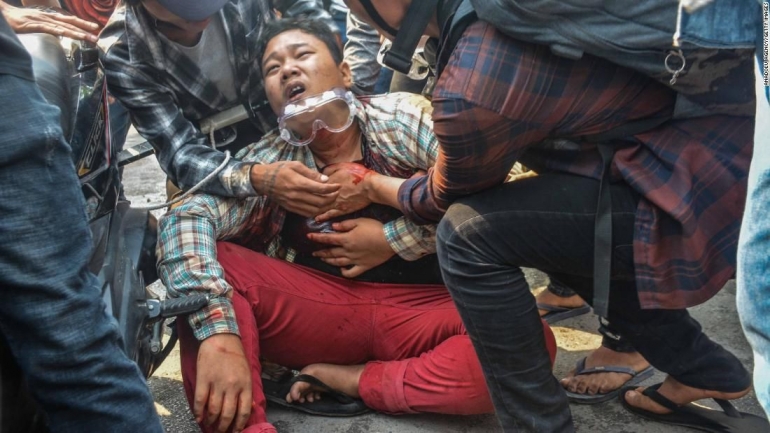 Pengunjuk rasa yang terluka pada aksi tanggal  27 Maret  2021.   Photo: CNN.  Image 