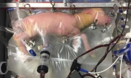 Anak domba dikanulasi pada usia kehamilan 107 hari dalam biobag (rahim artifisial). | Nature.com/ Rumah Sakit Anak Philadelphia via The Guardian