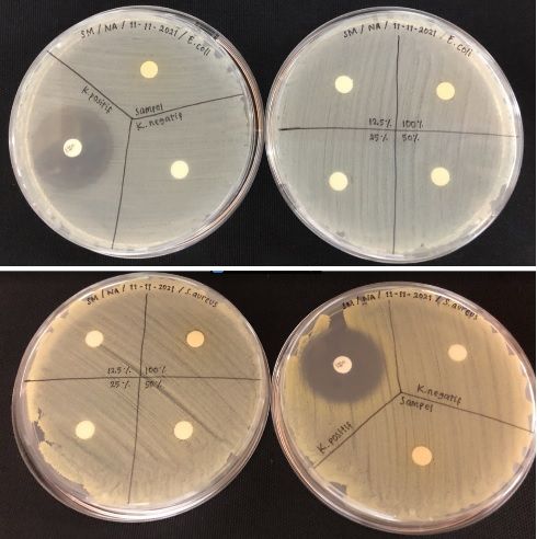 Hasil penelitian aktivitas antibakteri metode difusi cakram. Sumber: dokpri
